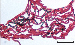 Endospores in Bacillus and Clostridium