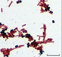 Gram-positive and Gram-negative bacteria