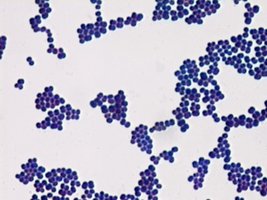 Crystal violet stained cells