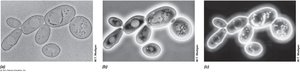Brightfield, phase contrast, and darkfield microscopy comparison