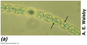 Anabaena cells under microscope