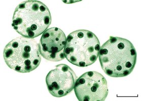 Algae micrograph