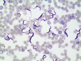 Protozoa under microscope