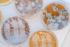 Petri dishes with colonies of Streptomyces, the bacteria producing tetracycline