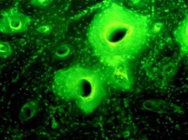 Fluorescent microscopy image of bone, representing tetracycline deposits
