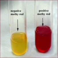 MR test: positive and negative results