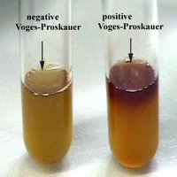 VP test: positive and negative results