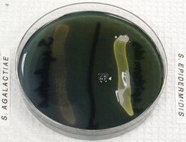 Starch hydrolysis negative: Streptococcus agalactiae and Staphylococcus epidermidis