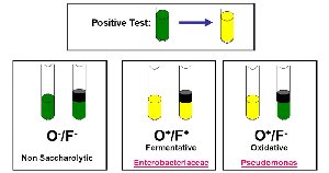 OF test: fermentative and oxidative results