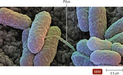 SEM image of pilus