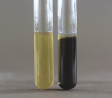 Bile esculin test: negative (left) and positive (right) results