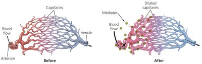 Dilating effect of inflammatory mediators on small blood vessels