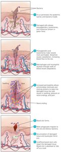 Overview of the events in inflammation following a cut and infection