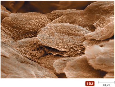 Scanning electron micrograph of the surface of human skin