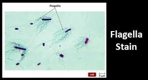 Flagella stain