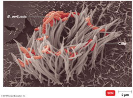 Bordetella pertussis on ciliated cells