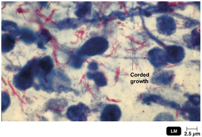 Mycobacterium tuberculosis, corded growth