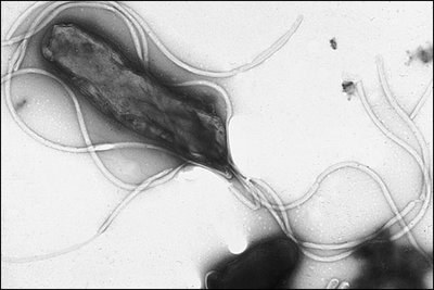 Helicobacter pylori with flagella