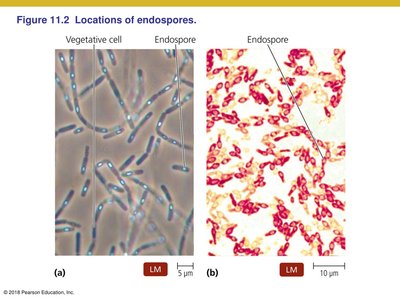 Locations of endospores in bacterial cells