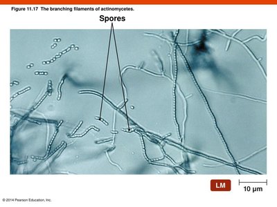 Branching filaments of actinomycetes with spores