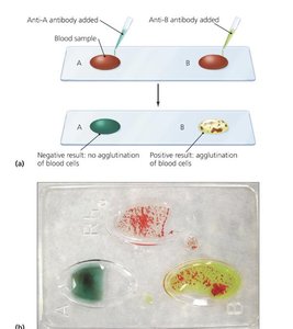 Hemagglutination test for blood typing