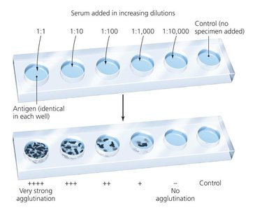 Titration using agglutination to quantify antibody levels