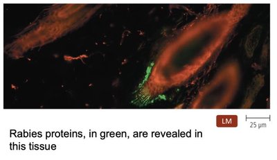 Direct fluorescent antibody test showing rabies proteins in tissue