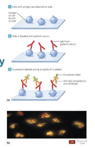 Indirect fluorescent antibody test steps and results