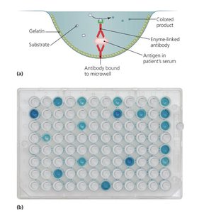 ELISA test showing colored product in microwell plate