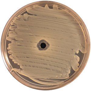 Kirby-Bauer disk diffusion test showing zone of inhibition
