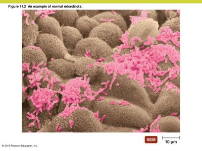 SEM image of normal microbiota on a surface