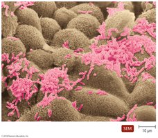SEM image of normal microbiota on human tissue