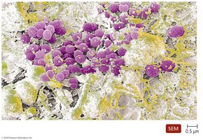 SEM image of biofilm formation