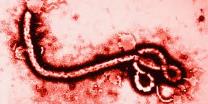 Ebola virus electron micrograph