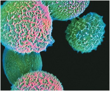 Colored scanning electron micrograph of fungal cells