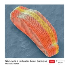 Scanning electron micrograph of a freshwater diatom