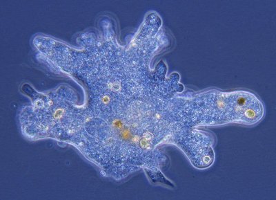 Light micrograph of a ciliate protozoan