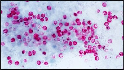 Cryptosporidium infestation in pool water
