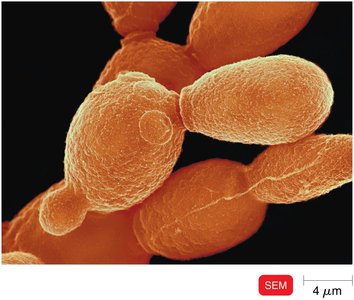 Scanning electron micrograph of budding yeast cells