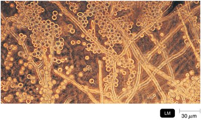 Light micrograph of moldlike growth showing hyphae and spores