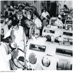 Iron lung machines used for polio patients