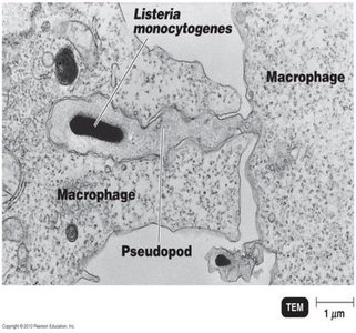 TEM of Listeria monocytogenes inside a macrophage