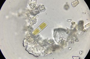 Microscopic algae under a microscope