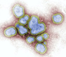 Microscopic image of viruses