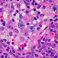 Microscopic image of mast cells