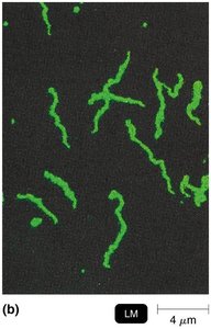 Fluorescence microscopy image
