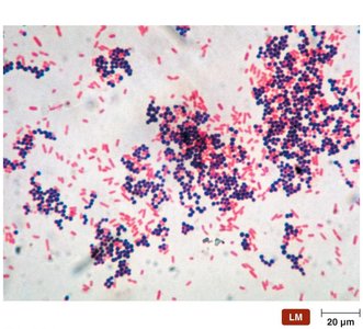 Gram stain showing Gram-positive and Gram-negative bacteria