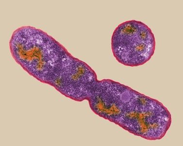 Electron micrograph of E. coli cell (prokaryote)