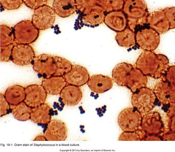 Gram stain of Staphylococcus in a blood culture