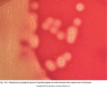 Streptococcus pyogenes on blood agar showing beta-hemolysis